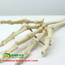 JOINT11 (12358) Modelos de esqueleto humano do braço superior da anatomia médica, modelo de esqueleto articulado do braço